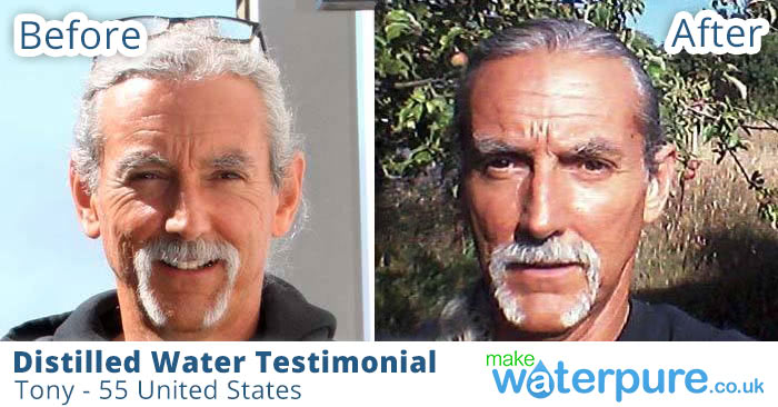 Tony age 55 Distilled Water Testimonial